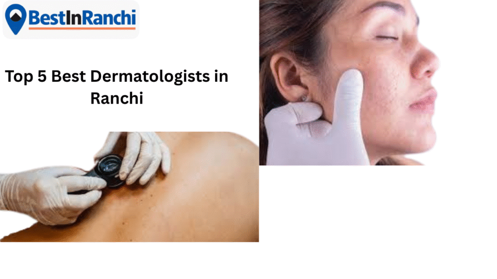 Best Dermatologists in Ranchi