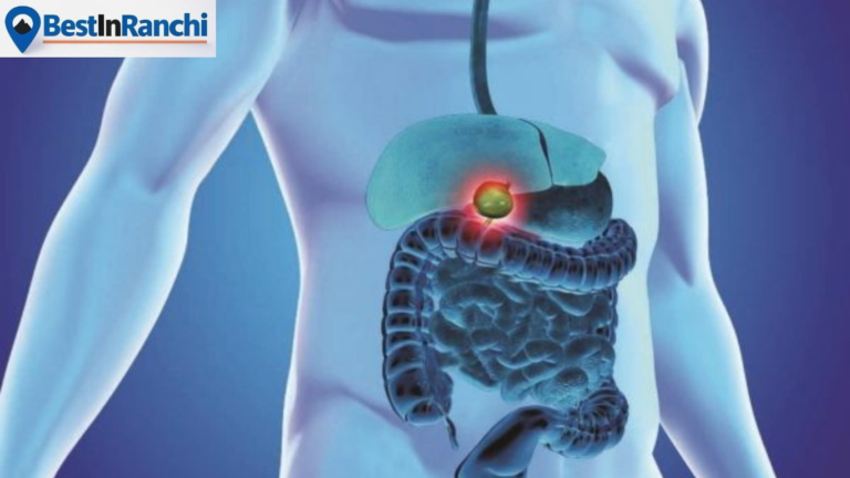 best laparoscopic surgeon in Ranchi